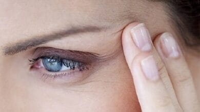 وصفات طبيعية فعالة للتخلص من تجاعيد العين