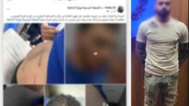 الشرطة بالقاهرة تكشف ملابسات اعتداء بسلاح أبيض على طالب