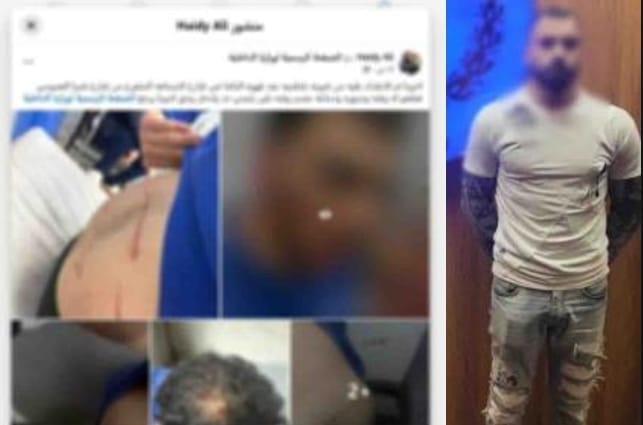 الشرطة بالقاهرة تكشف ملابسات اعتداء بسلاح أبيض على طالب