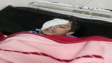 إصابة تلميذ بجرح خطير في العين بمدرسة بالمنوفية بسبب مشاجرة