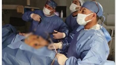 نجاح طبي بمستشفى تمي الأمديد في علاج انسداد القنوات المرارية واستئصال المرارة بالمنظار