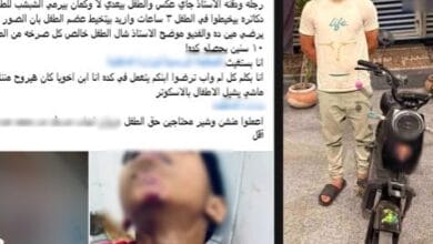 ضبط قائد سكوتر صدم طفلًا بالغربية