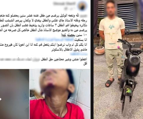 ضبط قائد سكوتر صدم طفلًا بالغربية