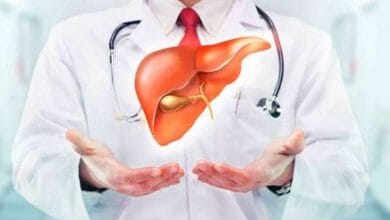 تليف الكبد: الأسباب، الأعراض، وطرق الوقاية